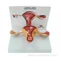 Larynx Heart And Lung Model Uterus Model with Pathology Factory